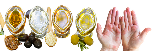 Moisturizing the Skin to Assist with the Symptoms of Eczema